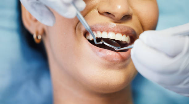 Best Emergency Tooth Extraction in Lake Ketchum, WA